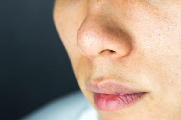 男生保养皮肤的护肤品顺序（男士应该如何正确挑选护肤品）.