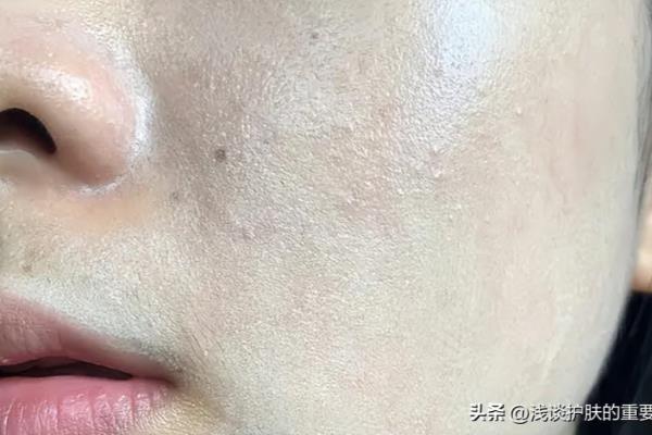 精华水干了再涂保湿乳吗（涂了保湿精华和面霜）.