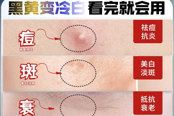 烟酰胺使用时要注意什么（美白界顶流「烟酰胺」使用说明书）.