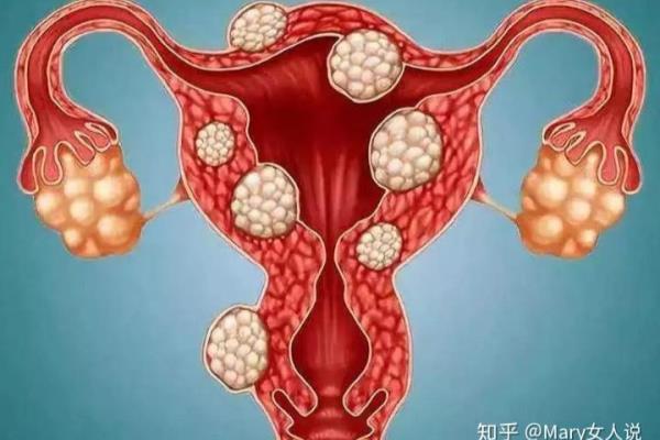 为什么我没有来大姨妈会有血流出来呀.