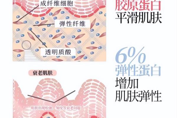 去皱纹打胶原蛋白好还是玻尿酸好