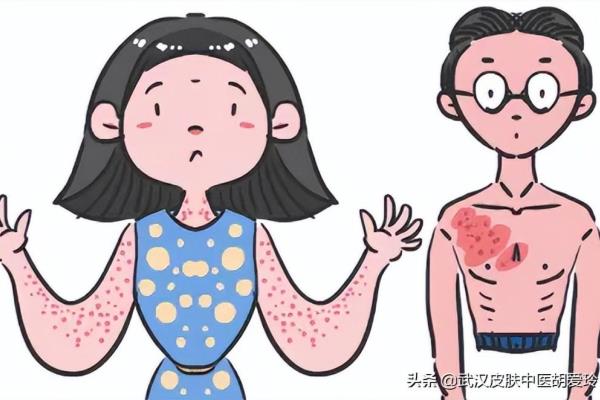 胸窝中间有个包不疼不痒怎么回事儿