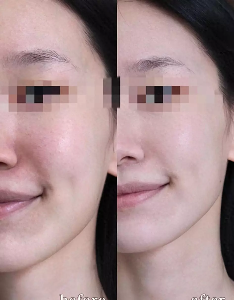 柳丝木隔离成分安全吗(5)